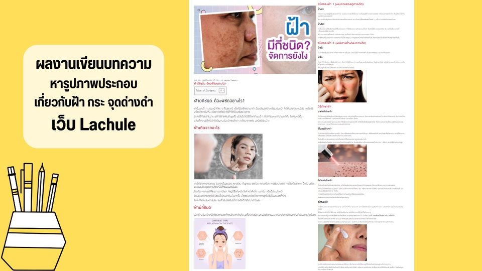 รับเขียนบทความเกี่ยวกับฝ้า กระ จุดด่างดำ บทความSEO