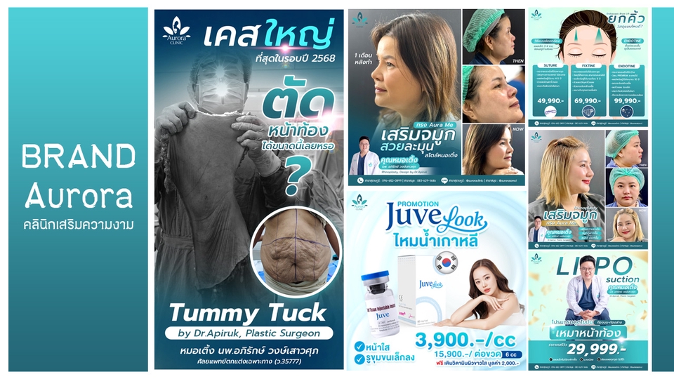 ออกแบบแบนเนอร์คลินิกเสริมความงาม ภาพรีวิว เขียนรีวิว Before After ภาพก่อนหลัง