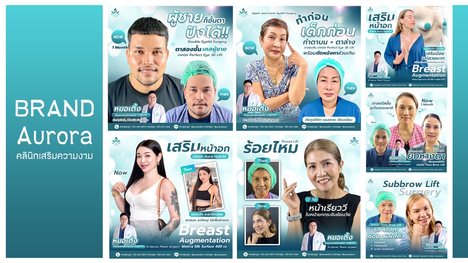 ออกแบบแบนเนอร์ Aurora คลินิกเสริมความงาม ศัลยกรรมตกเเต่ง Clinic