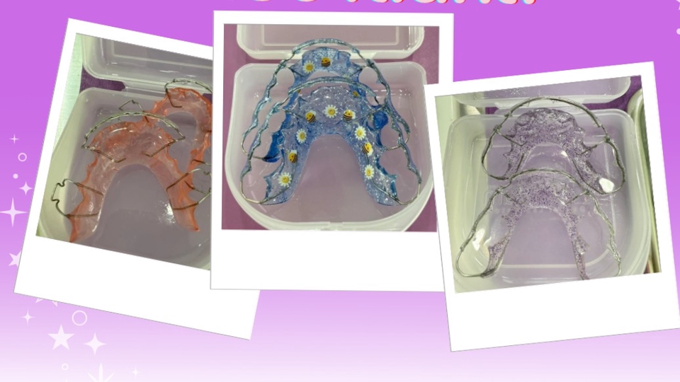 การลงโปรโมทตัวอย่างลายรีเทนเนอร์