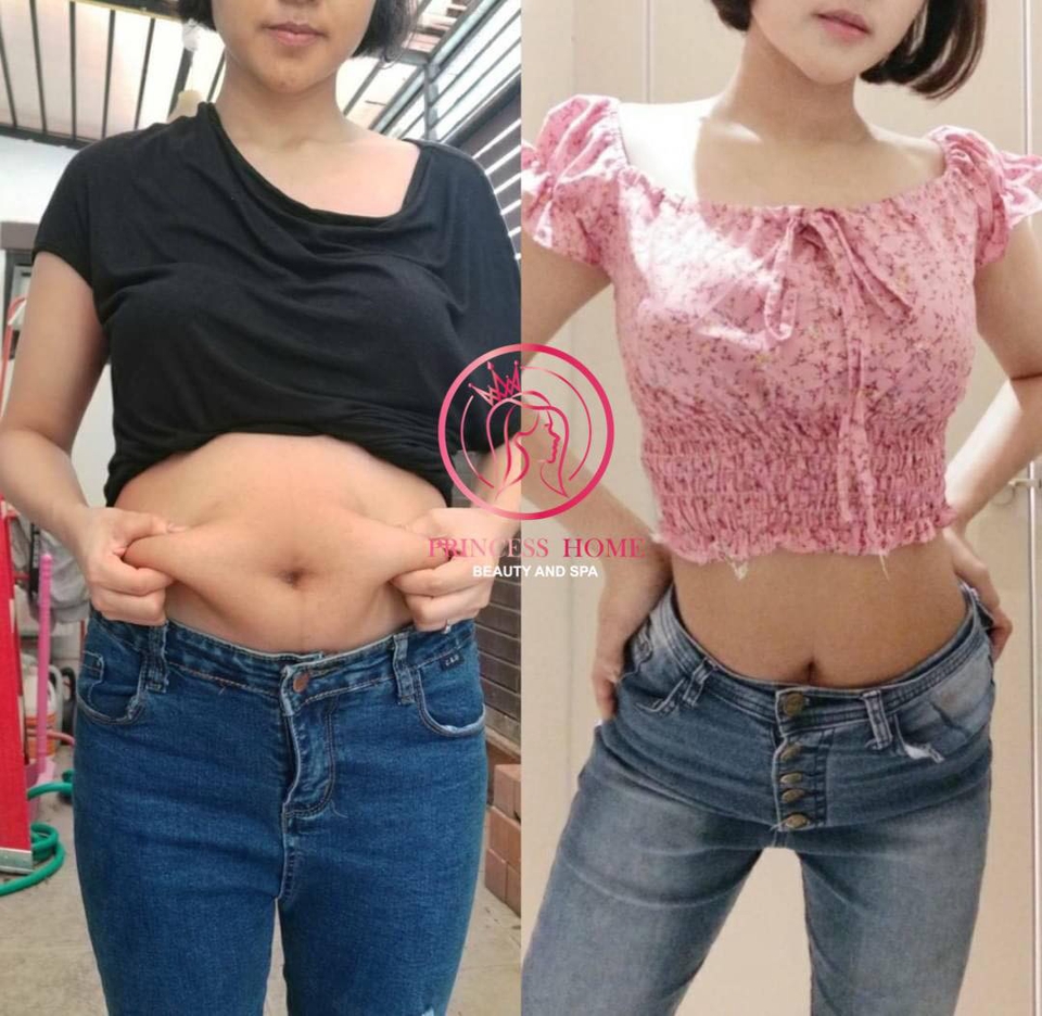 นวด - รับสอนนวดสลายไขมันกระชับหุ่น - 2