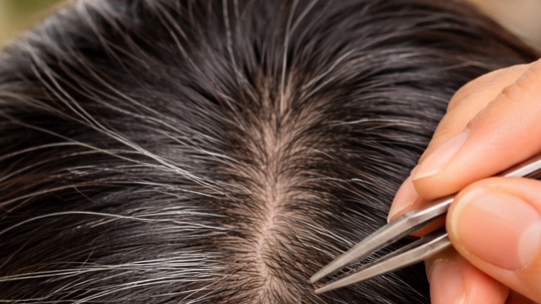 รับจ้างถอนผมหงอก