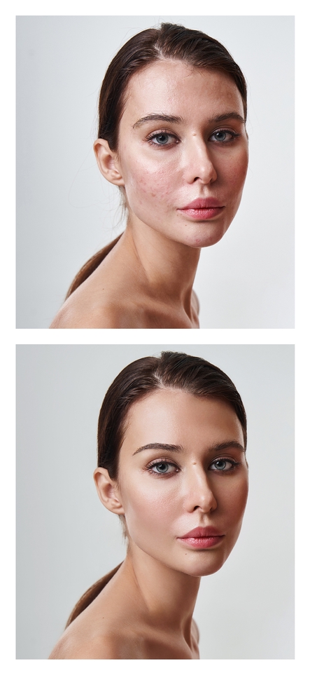 ปรับสีผิวให้เนียนสวย ลบริ้วรอยและแก้ไขภาพถ่ายให้ดูดีขึ้น บริการรีทัชภาพถ่ายสินค้า, รีทัช