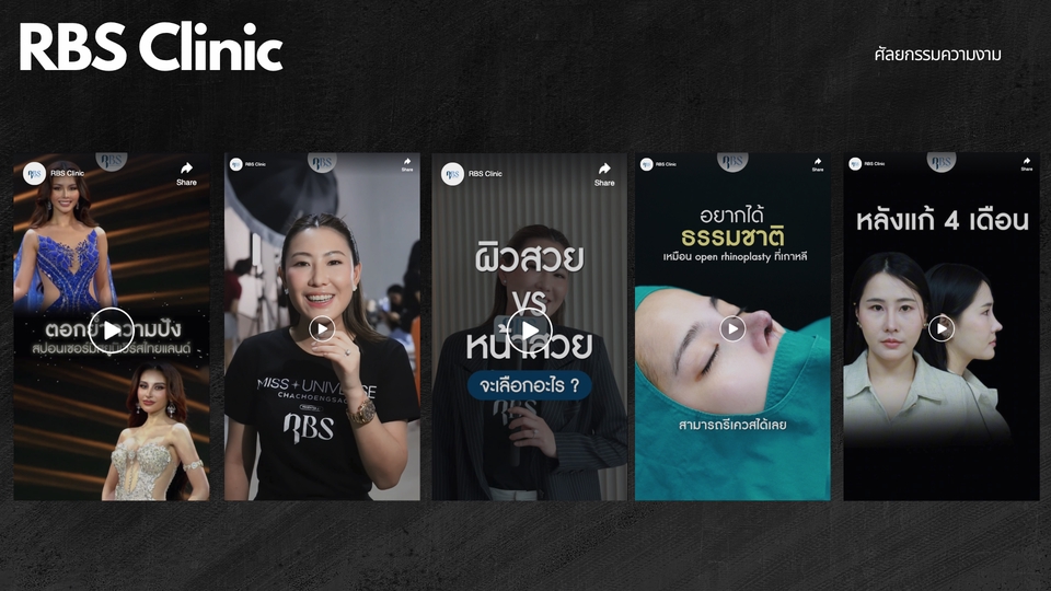รับตัดต่อวีดีโอโฆษณา RBS Clinic รีวิวศัลยกรรม