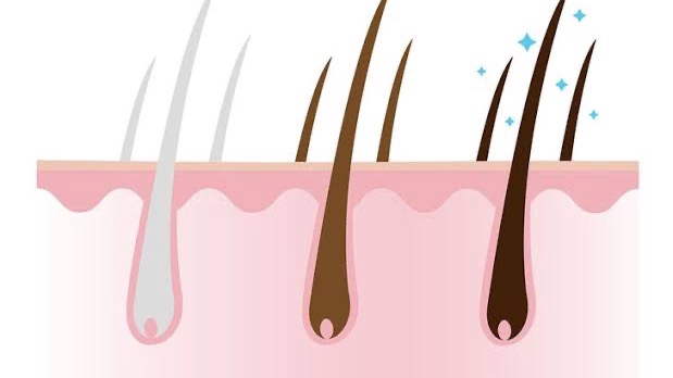 รับถอนผมหงอก