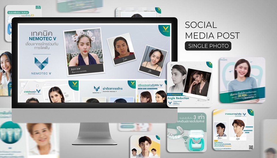 ออกแบบแบนเนอร์เฟสบุ๊ค NEMOTEC V โปรโมชั่นจัดฟัน