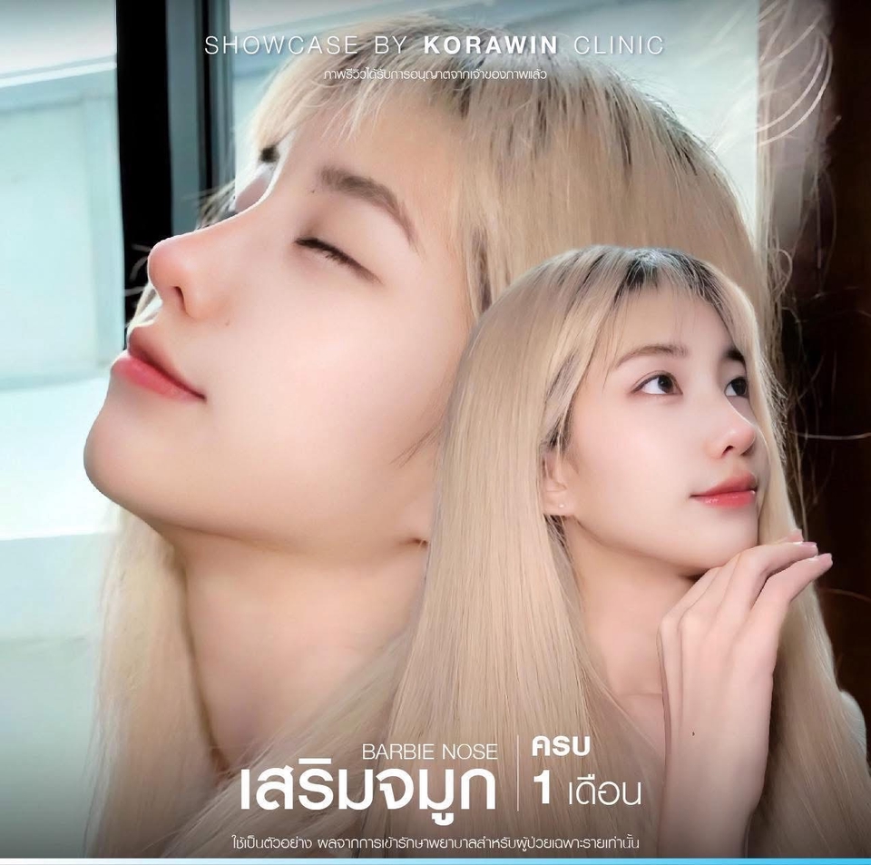 เสริมจมูกแบบบาร์บี้ เน็ตไอดอลรีวิว ศัลยกรรม